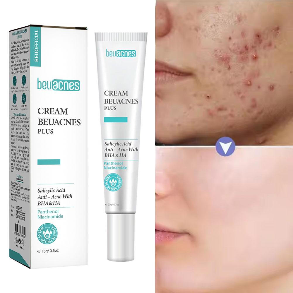 Skincare Niacinamide - Nouveau 20g Niacinamide Gel d'acné Anti-acné