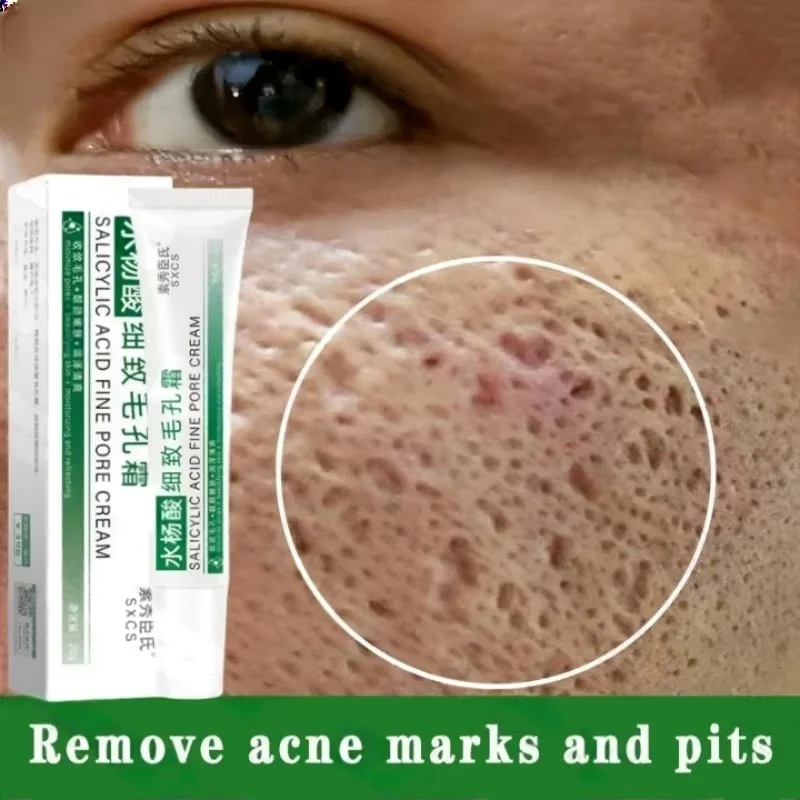 Azelaic Acid Cream - Crème de nettoyage des pores à