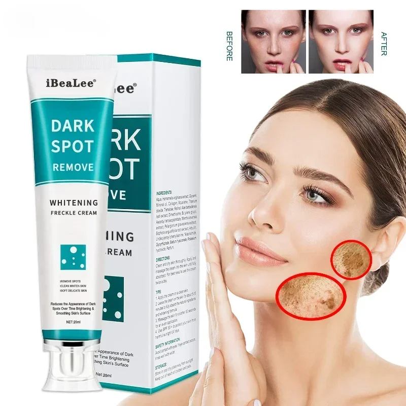 Crème blanchissante pour les t - Skincare Glowing avis et prix