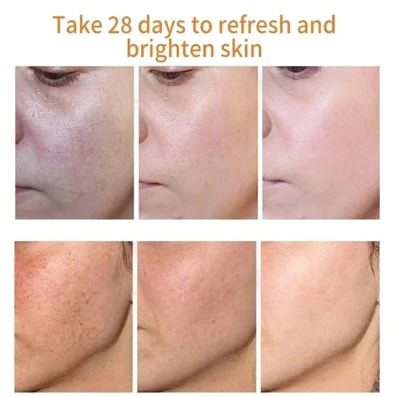 Crème blanchissante à la niaci - Skincare Niacinamide avis et prix