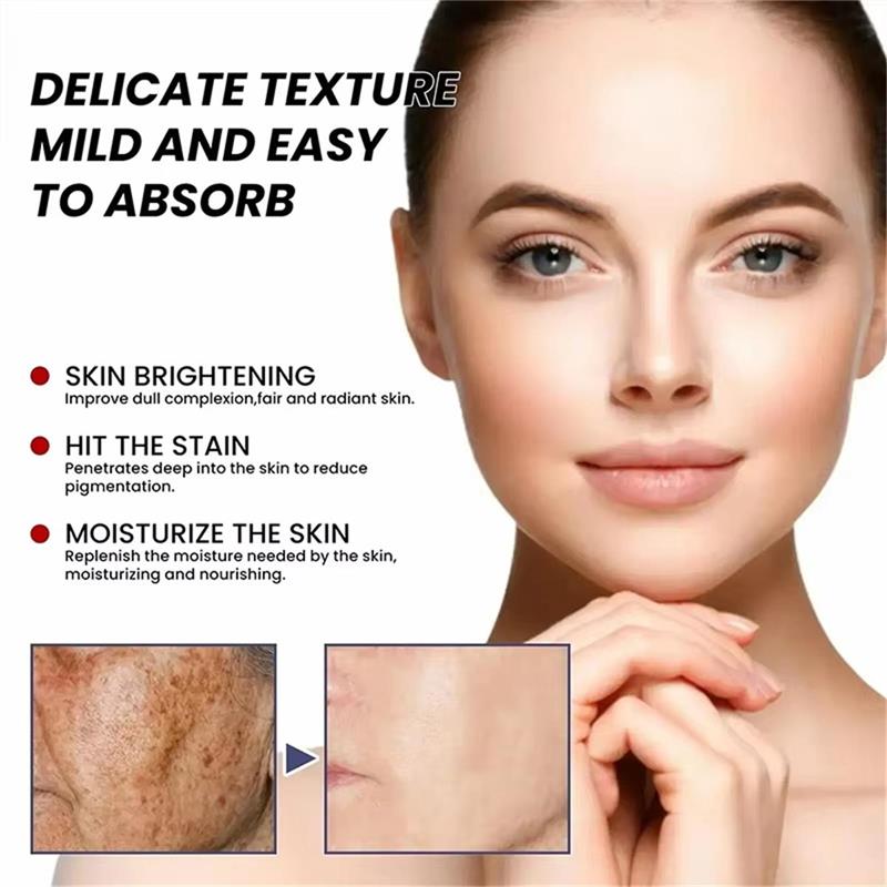 Crème Éclaircissante Anti-Tach - Skincare Niacinamide avis et prix